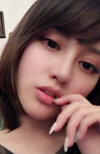 自体脂肪填充术