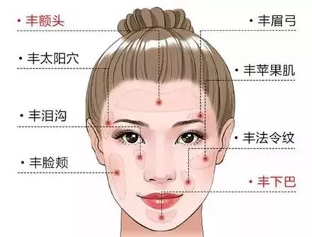 自体脂肪填充术