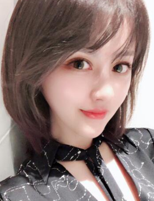 自体脂肪填充术