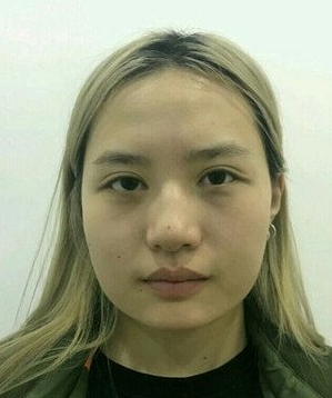 超声波瘦脸