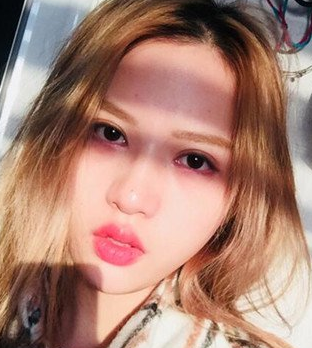 超声波瘦脸