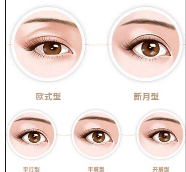 双眼皮手术