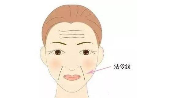 面部提升术
