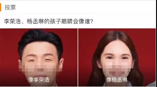 双眼皮手术