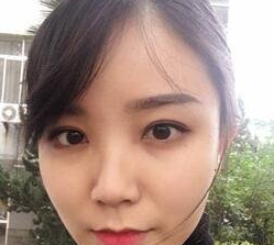 双眼皮手术