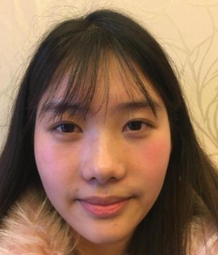 隆鼻手术