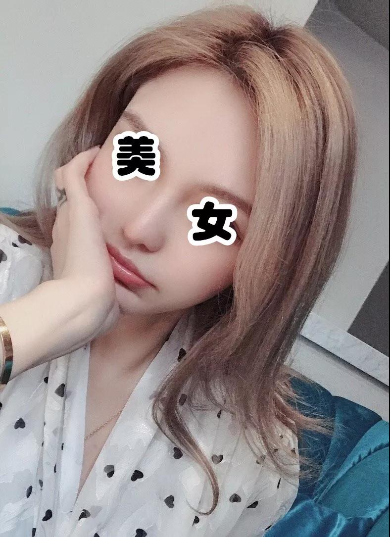 自体脂肪填充术