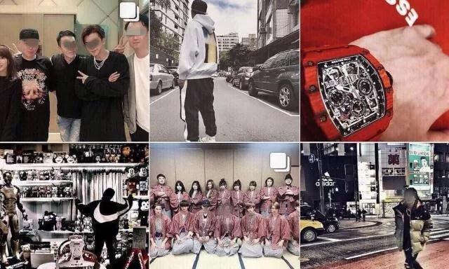 自体脂肪填充术