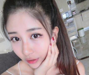 双眼皮手术