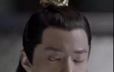 双眼皮手术
