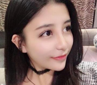 双眼皮手术