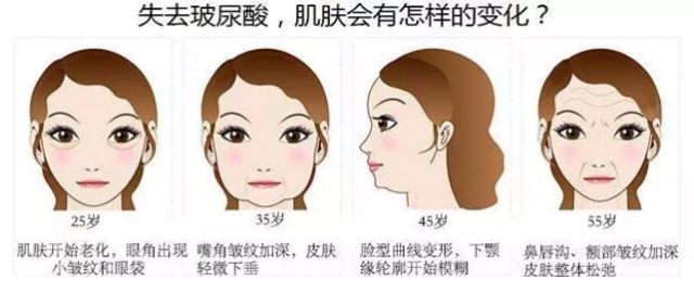 玻尿酸