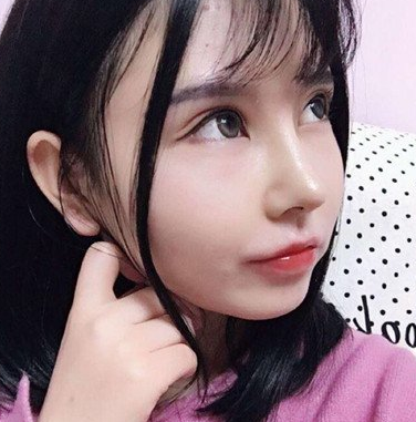 隆鼻手术