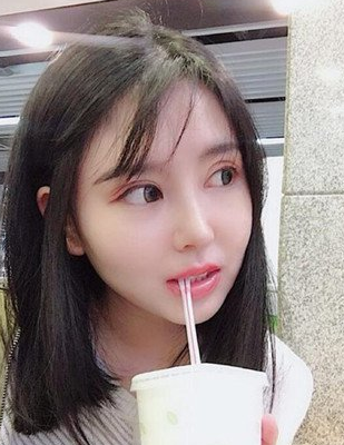 隆鼻手术