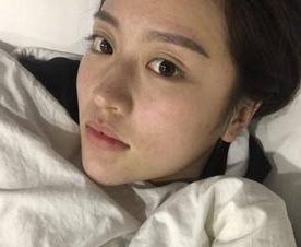 超声波瘦脸