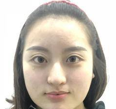 超声波瘦脸