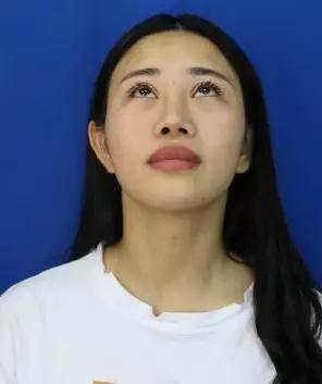 隆鼻手术