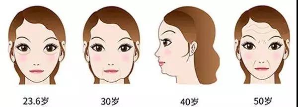 面部提升术