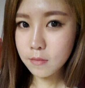 玻尿酸