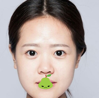 双眼皮手术
