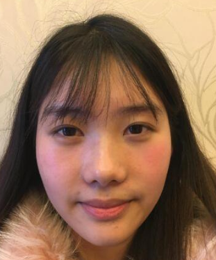 隆鼻手术