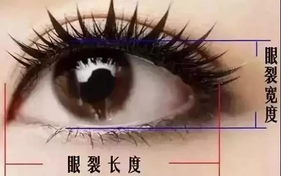 双眼皮手术