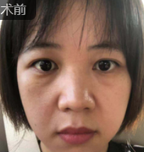 重庆超雅