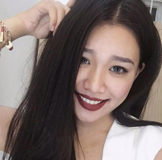 玻尿酸填充术