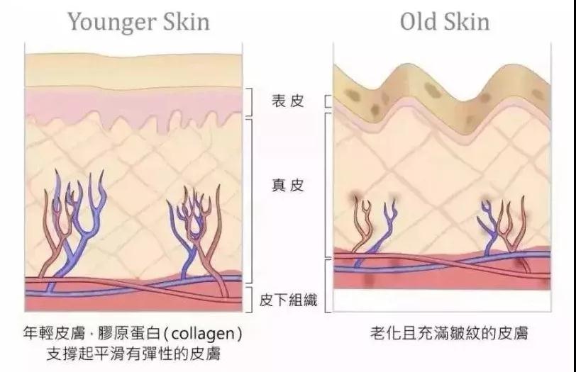 自体脂肪填充术
