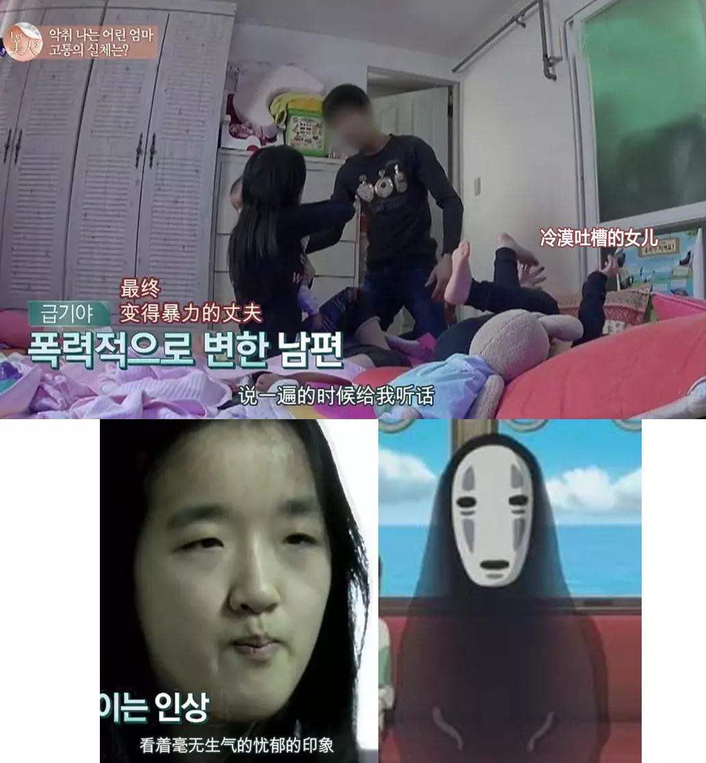 双眼皮手术