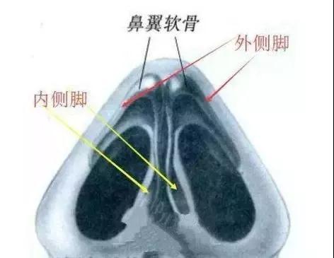 隆鼻手术