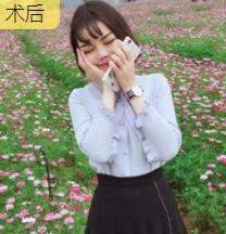 超声波瘦脸
