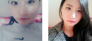 超声波瘦脸