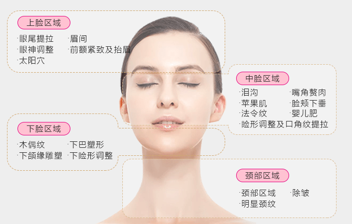 面部提升术