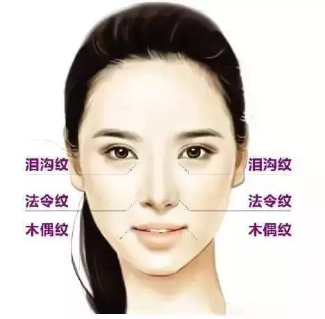 面部提升术