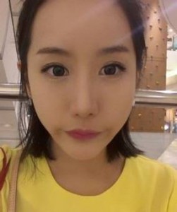 超声波去眼袋