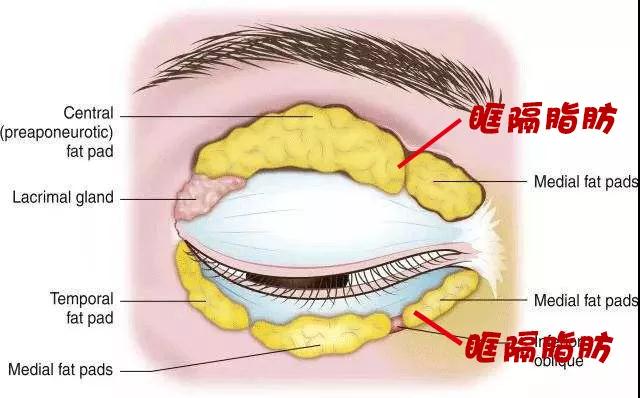 双眼皮手术