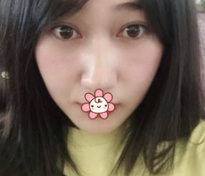 超声波去眼袋