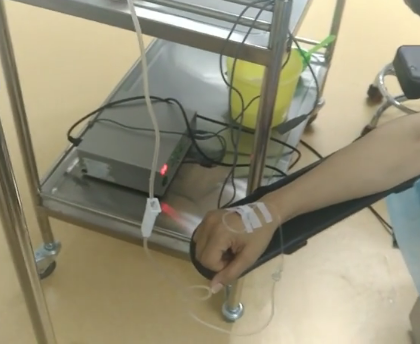 超声波去眼袋