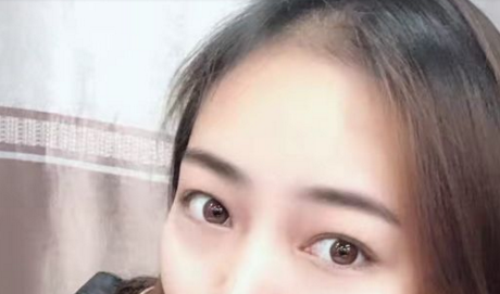 超声波去眼袋