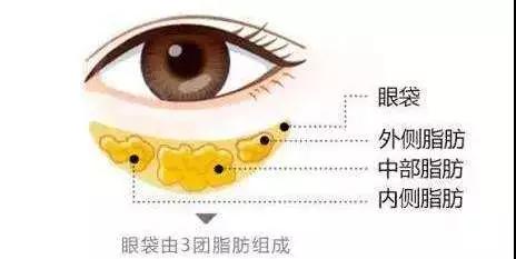 超声波去眼袋
