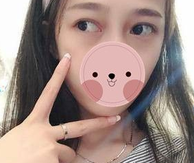 超声波去眼袋