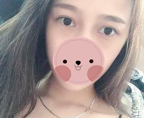 超声波去眼袋