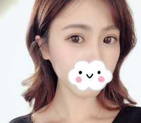 超声波去眼袋