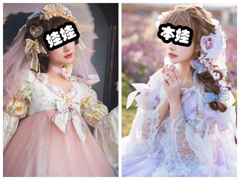 双眼皮手术