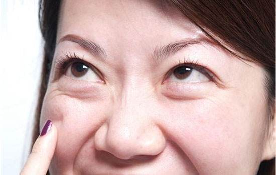去眼袋手术