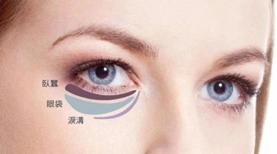 去眼袋手术