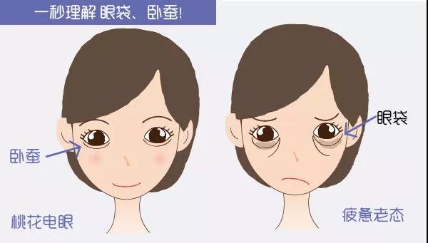 去眼袋手术