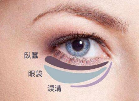 去眼袋手术