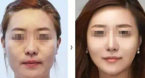 超级微拉美